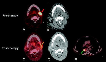 Fig 8.