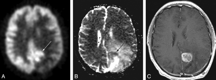 Fig 1.