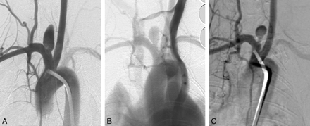Fig 3.