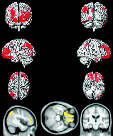 Fig 4.