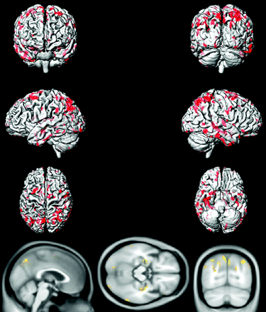 Fig 5.
