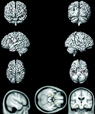 Fig 6.