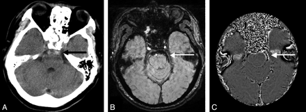 Fig 3.