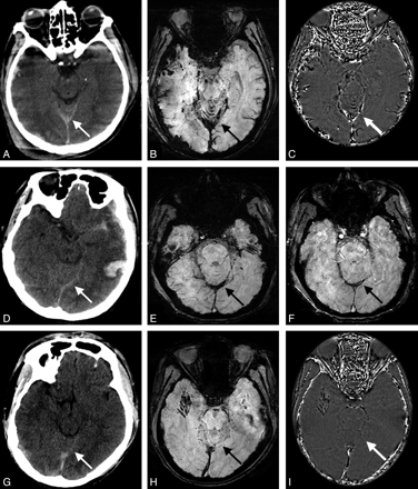 Fig 4.