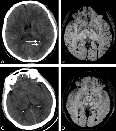 Fig 5.