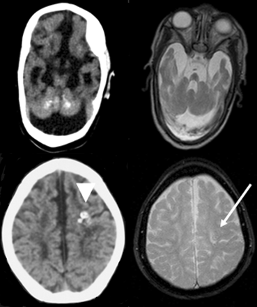 Fig 1.