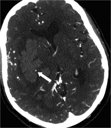 Fig 3.