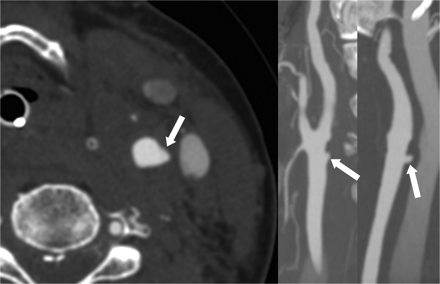 Fig 4.