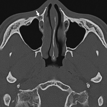 Fig 3.