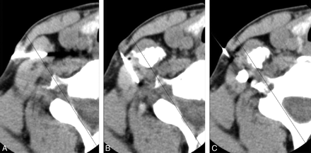 Fig 2.