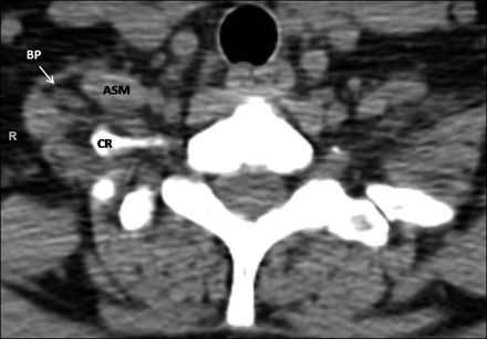 Fig 5.