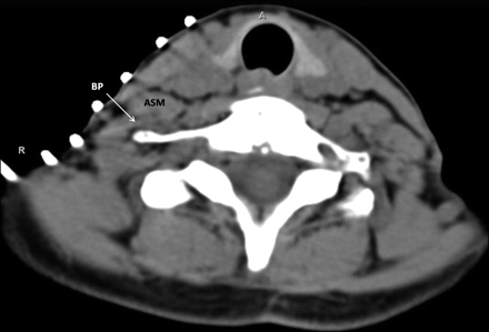 Fig 6.