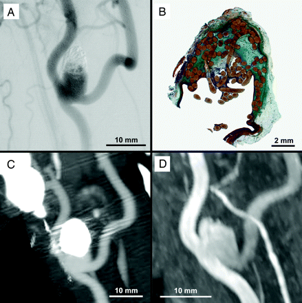 Fig 2.
