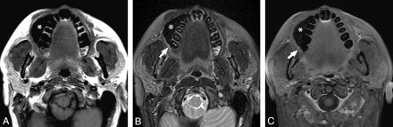 Fig 1.