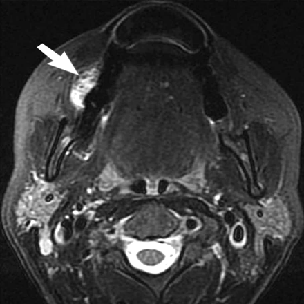 Fig 2.