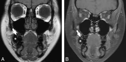 Fig 3.