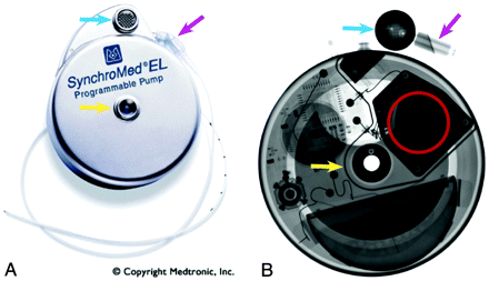 Fig 2.