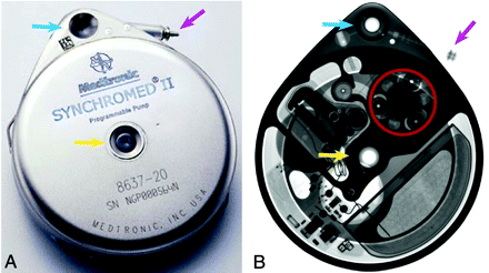 Fig 3.