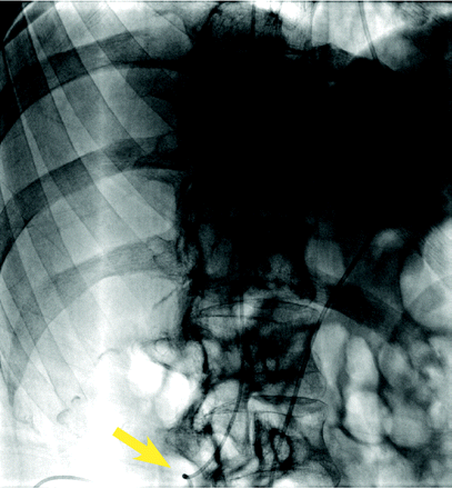 Fig 4.