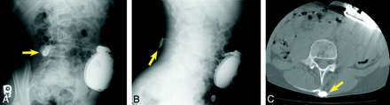 Fig 8.