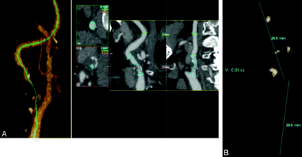 Fig 4.