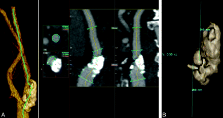 Fig 5.