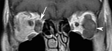 Fig 1.