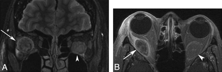 Fig 3.