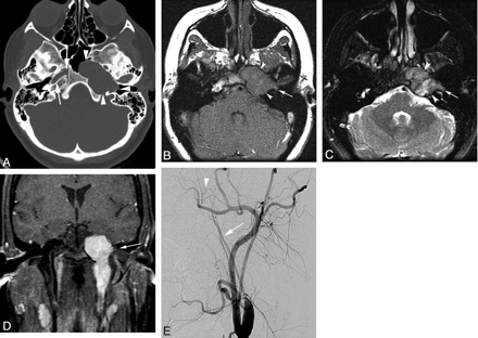 Fig 1.