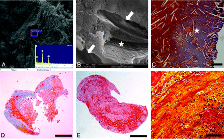 Fig 3.