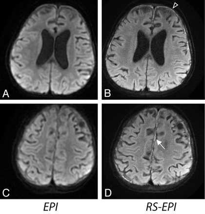 Fig 3.