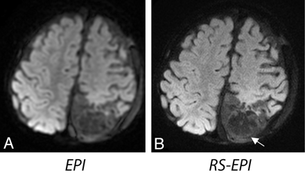 Fig 5.