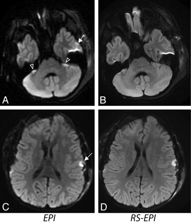 Fig 6.