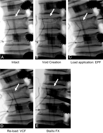 Fig 2.