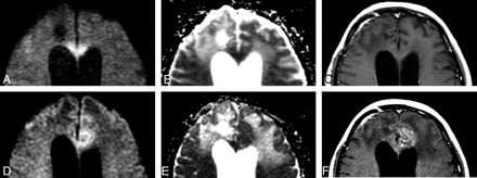 Fig 1.