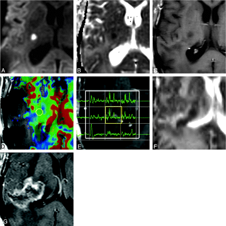Fig 4.
