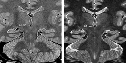 Fig 3.