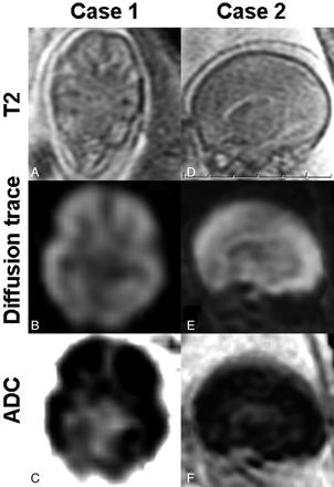 Fig 1.