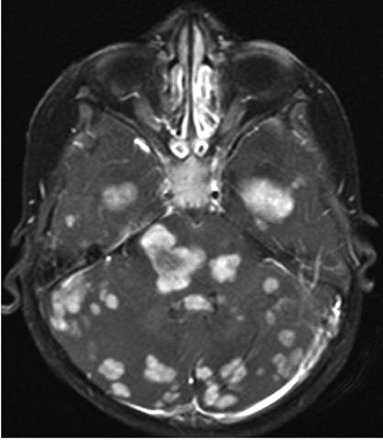Fig 2.