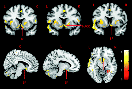 Fig 1.