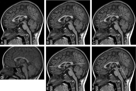 Fig 1.