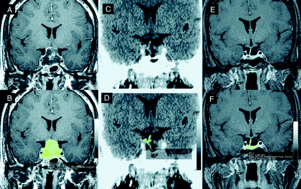 Fig 1.