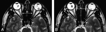 Fig 1.