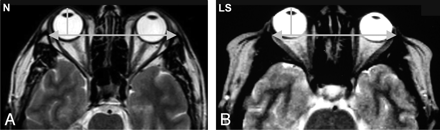 Fig 2.