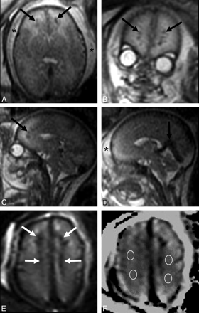 Fig 1.