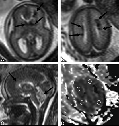 Fig 3.