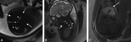 Fig 1.
