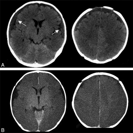 Fig 1.