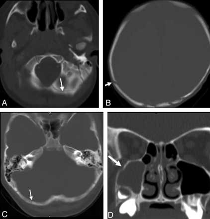 Fig 3.