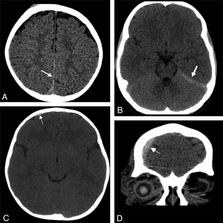 Fig 4.